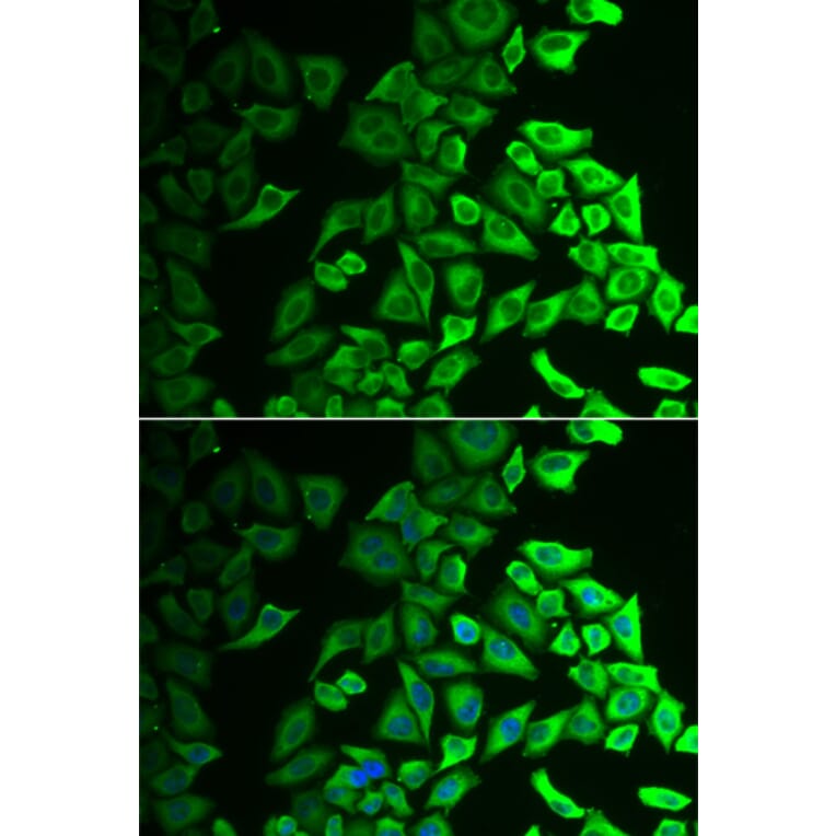 Immunofluorescence - Anti-IL-18BP Antibody (A11975) - Antibodies.com