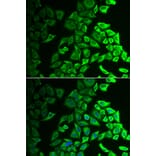 Immunofluorescence - Anti-IL-18BP Antibody (A11975) - Antibodies.com