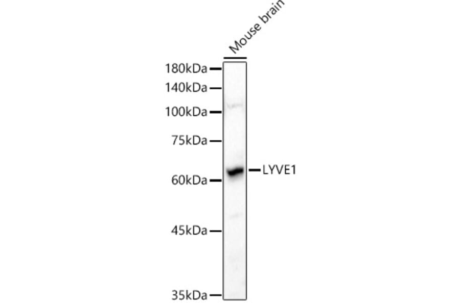 Western Blot - Anti-LYVE1 Antibody (A11976) - Antibodies.com