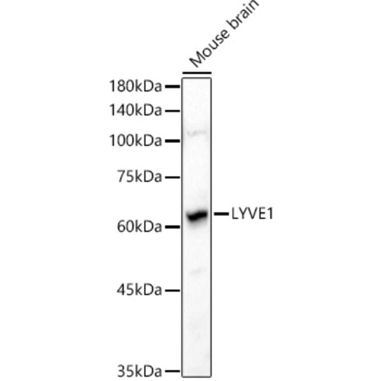 Western Blot - Anti-LYVE1 Antibody (A11976) - Antibodies.com