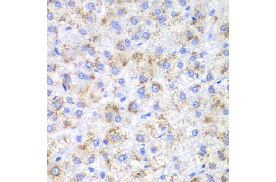Immunohistochemistry - Anti-HAO1/GOX Antibody (A11977) - Antibodies.com