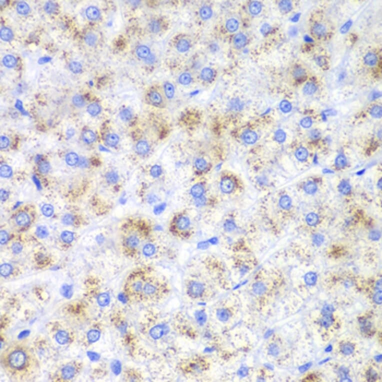 Immunohistochemistry - Anti-HAO1/GOX Antibody (A11977) - Antibodies.com