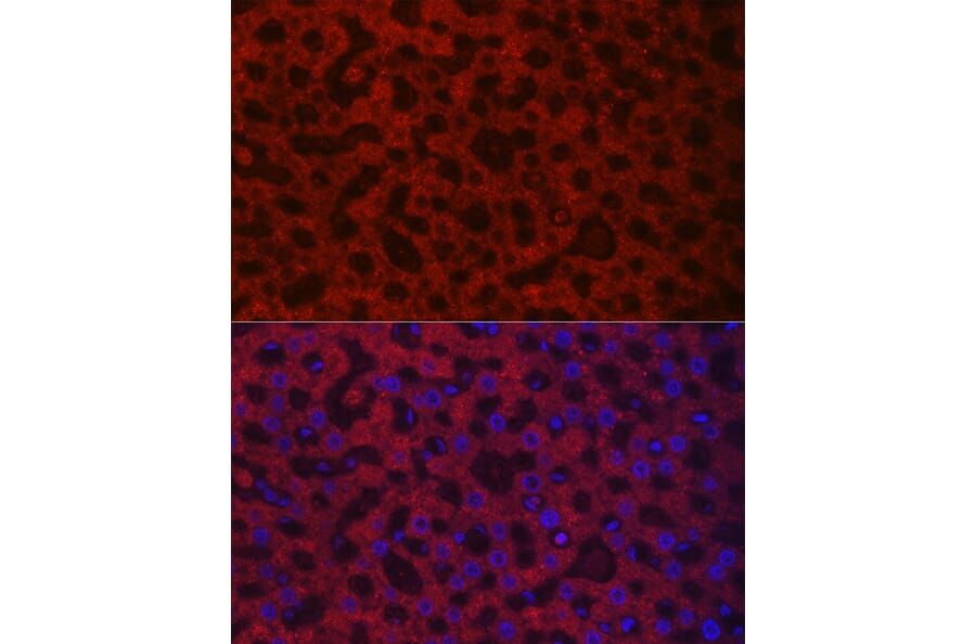 Immunofluorescence - Anti-HAO1/GOX Antibody (A11977) - Antibodies.com