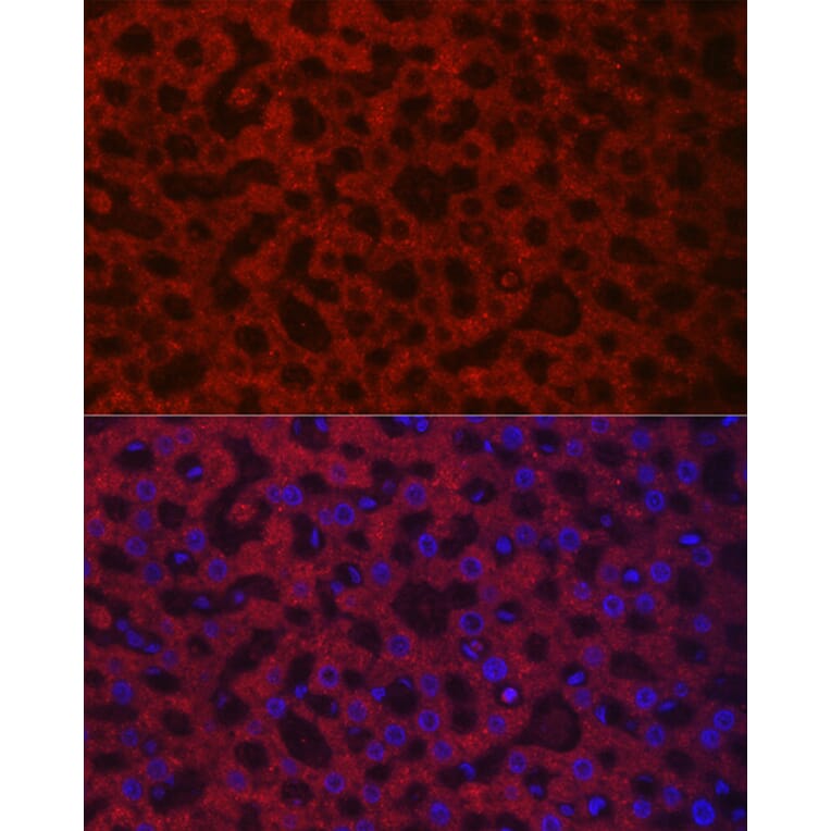 Immunofluorescence - Anti-HAO1/GOX Antibody (A11977) - Antibodies.com