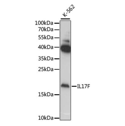 Western Blot - Anti-IL-17F Antibody (A11979) - Antibodies.com