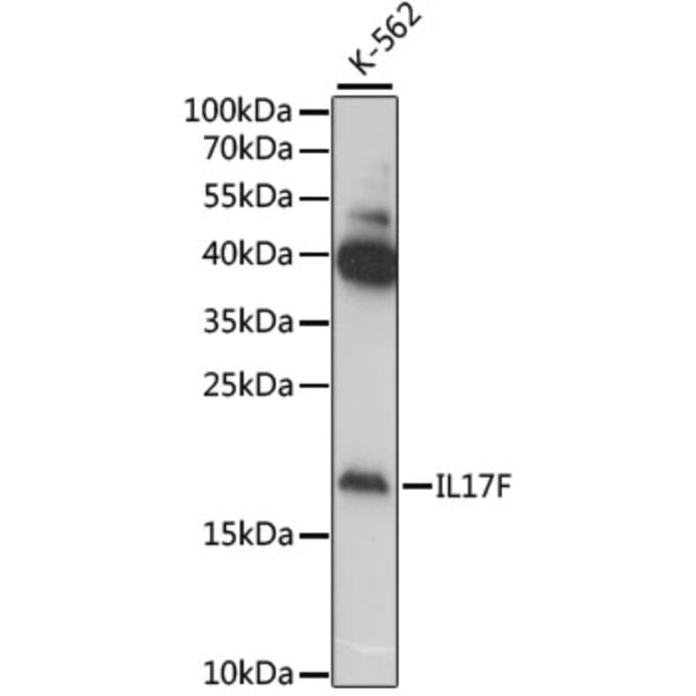 Western Blot - Anti-IL-17F Antibody (A11979) - Antibodies.com