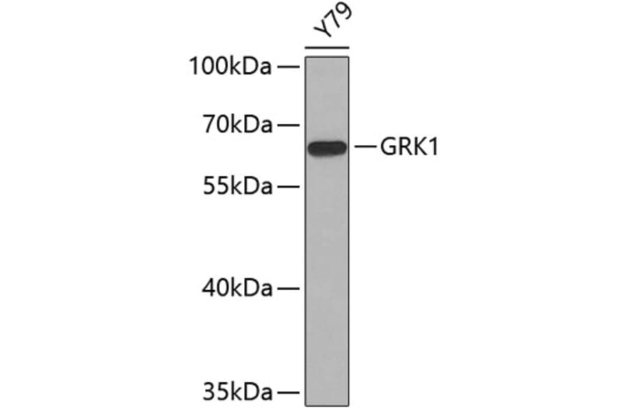 Western Blot - Anti-GRK1 Antibody (A11981) - Antibodies.com