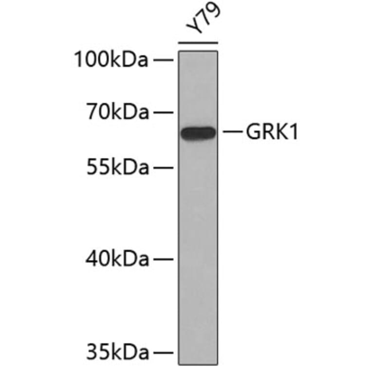 Western Blot - Anti-GRK1 Antibody (A11981) - Antibodies.com