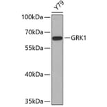 Western Blot - Anti-GRK1 Antibody (A11981) - Antibodies.com