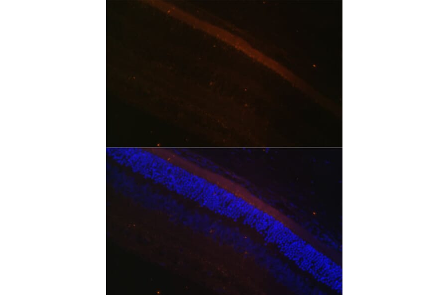 Immunofluorescence - Anti-GRK1 Antibody (A11981) - Antibodies.com