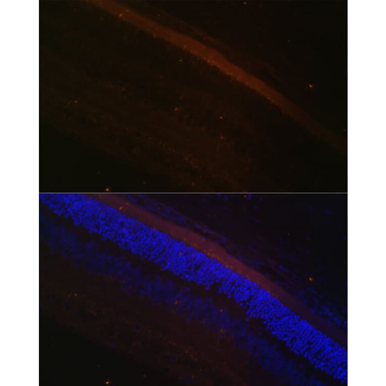 Immunofluorescence - Anti-GRK1 Antibody (A11981) - Antibodies.com