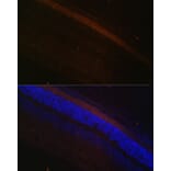 Immunofluorescence - Anti-GRK1 Antibody (A11981) - Antibodies.com