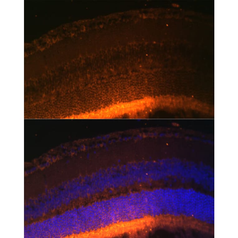 Immunofluorescence - Anti-GRK1 Antibody (A11981) - Antibodies.com