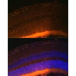 Immunofluorescence - Anti-GRK1 Antibody (A11981) - Antibodies.com