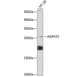 Western Blot - Anti-Agpat2 Antibody (A11983) - Antibodies.com