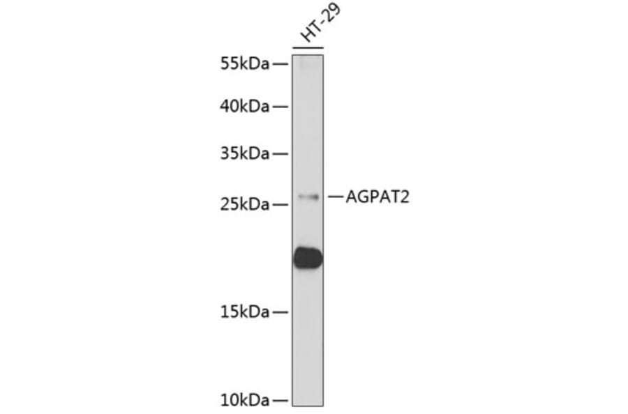 Western Blot - Anti-Agpat2 Antibody (A11983) - Antibodies.com