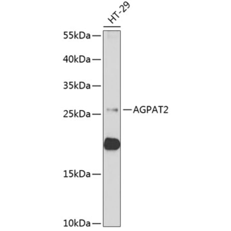Western Blot - Anti-Agpat2 Antibody (A11983) - Antibodies.com