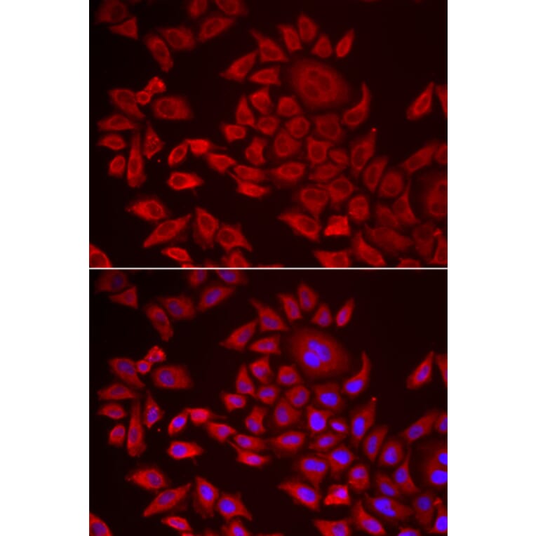 Immunofluorescence - Anti-Agpat2 Antibody (A11983) - Antibodies.com