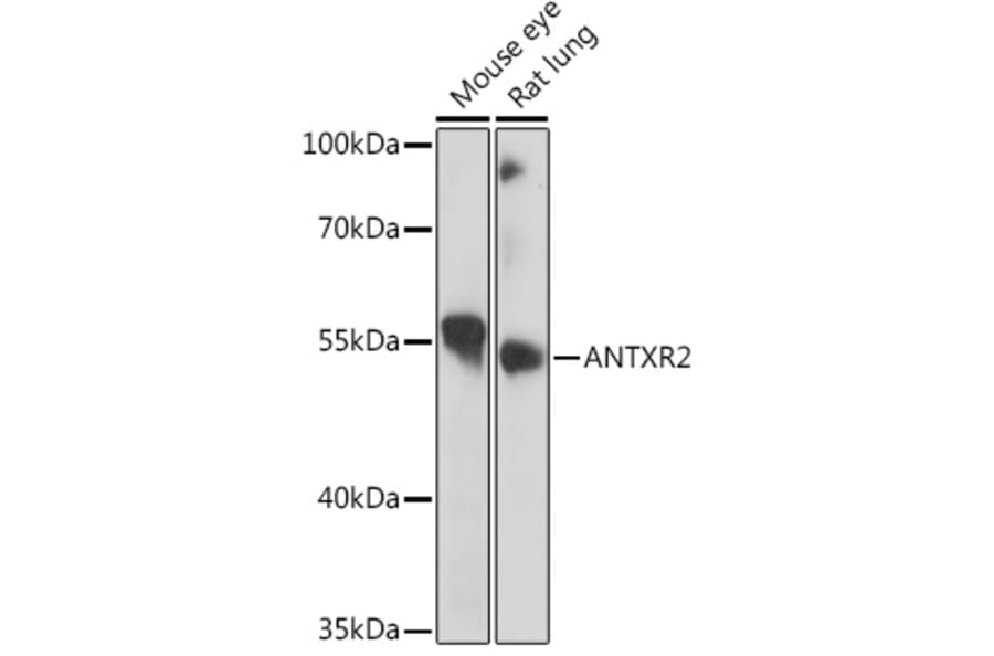 Western Blot - Anti-ANTXR2/CMG-2 Antibody (A11984) - Antibodies.com