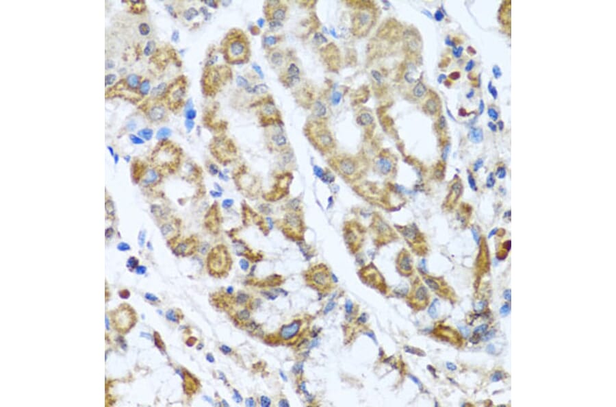 Immunohistochemistry - Anti-ANTXR2/CMG-2 Antibody (A11984) - Antibodies.com