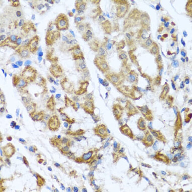 Immunohistochemistry - Anti-ANTXR2/CMG-2 Antibody (A11984) - Antibodies.com