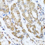 Immunohistochemistry - Anti-ANTXR2/CMG-2 Antibody (A11984) - Antibodies.com