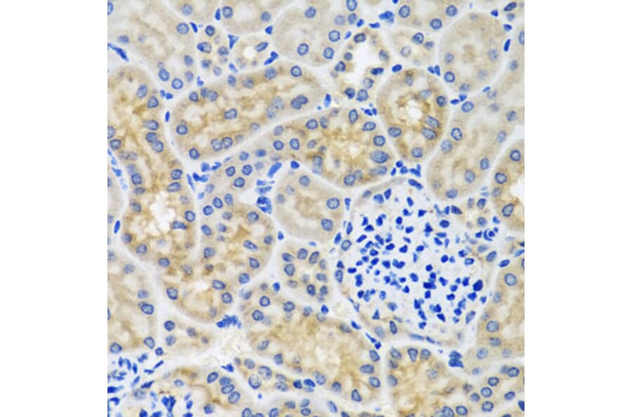 Immunohistochemistry - Anti-ANTXR2/CMG-2 Antibody (A11984) - Antibodies.com