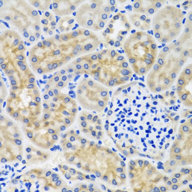 Immunohistochemistry - Anti-ANTXR2/CMG-2 Antibody (A11984) - Antibodies.com