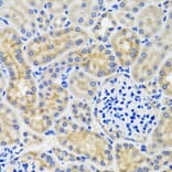 Immunohistochemistry - Anti-ANTXR2/CMG-2 Antibody (A11984) - Antibodies.com