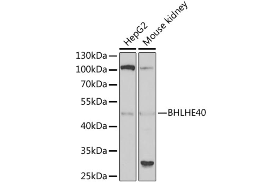 Western Blot - Anti-SHARP2/DEC1 Antibody (A11985) - Antibodies.com