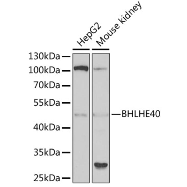 Western Blot - Anti-SHARP2/DEC1 Antibody (A11985) - Antibodies.com