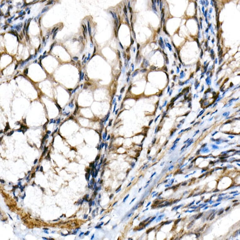 Immunohistochemistry - Anti-SHARP2/DEC1 Antibody (A11985) - Antibodies.com