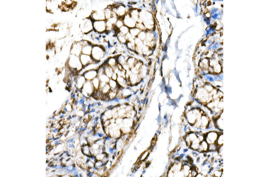 Immunohistochemistry - Anti-SHARP2/DEC1 Antibody (A11985) - Antibodies.com