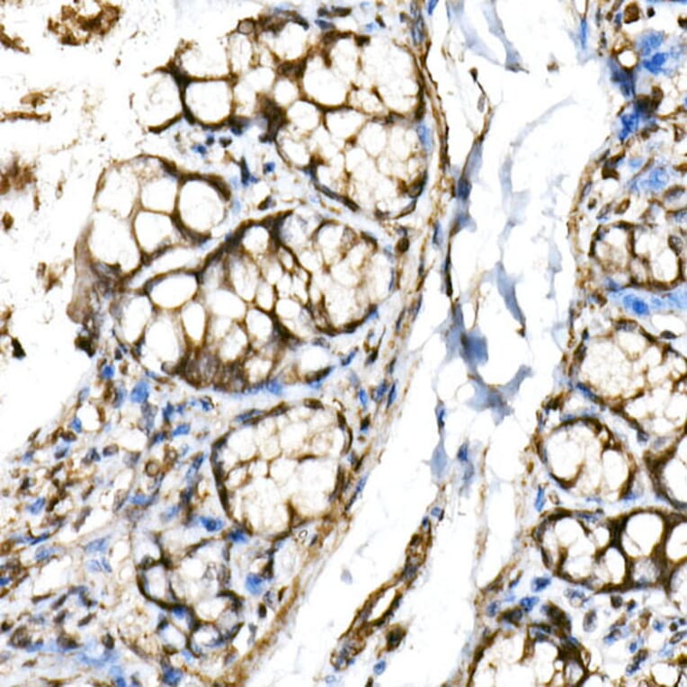 Immunohistochemistry - Anti-SHARP2/DEC1 Antibody (A11985) - Antibodies.com