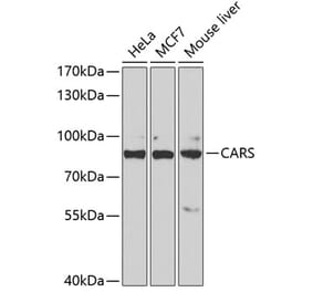 Western Blot - Anti-CARS Antibody (A11986) - Antibodies.com