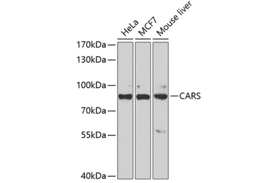 Western Blot - Anti-CARS Antibody (A11986) - Antibodies.com