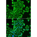 Immunofluorescence - Anti-CARS Antibody (A11986) - Antibodies.com