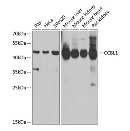 Western Blot - Anti-CCBL1 Antibody (A11987) - Antibodies.com