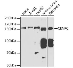 Western Blot - Anti-CENPC Antibody (A11988) - Antibodies.com