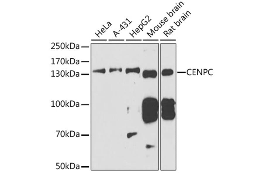 Western Blot - Anti-CENPC Antibody (A11988) - Antibodies.com