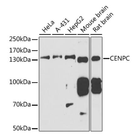 Western Blot - Anti-CENPC Antibody (A11988) - Antibodies.com