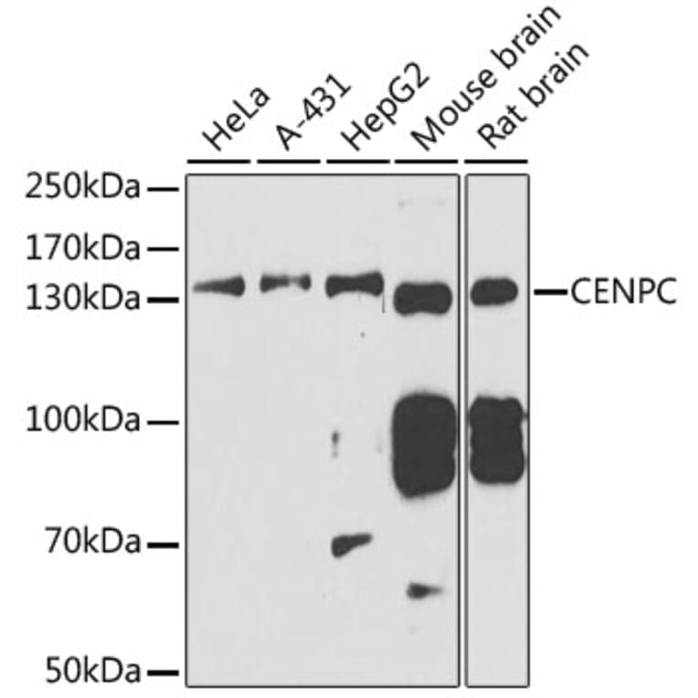 Western Blot - Anti-CENPC Antibody (A11988) - Antibodies.com