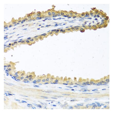 Immunohistochemistry - Anti-COCH Antibody (A11989) - Antibodies.com