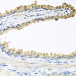 Immunohistochemistry - Anti-COCH Antibody (A11989) - Antibodies.com