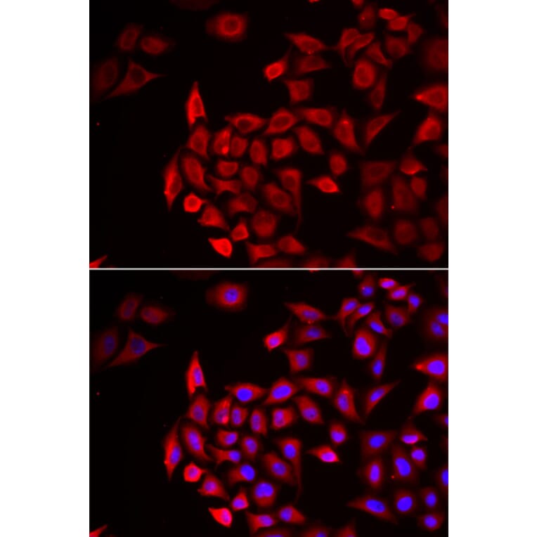 Immunofluorescence - Anti-COCH Antibody (A11989) - Antibodies.com