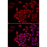 Immunofluorescence - Anti-COCH Antibody (A11989) - Antibodies.com