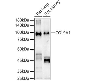 Western Blot - Anti-COL9A1 Antibody (A11990) - Antibodies.com