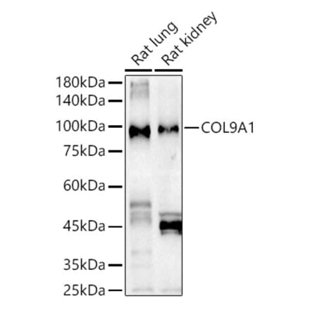 Western Blot - Anti-COL9A1 Antibody (A11990) - Antibodies.com