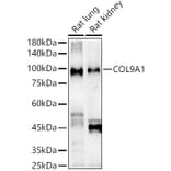 Western Blot - Anti-COL9A1 Antibody (A11990) - Antibodies.com