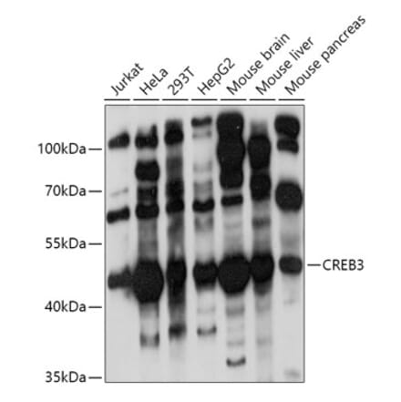 Western Blot - Anti-CREB3 Antibody (A11991) - Antibodies.com